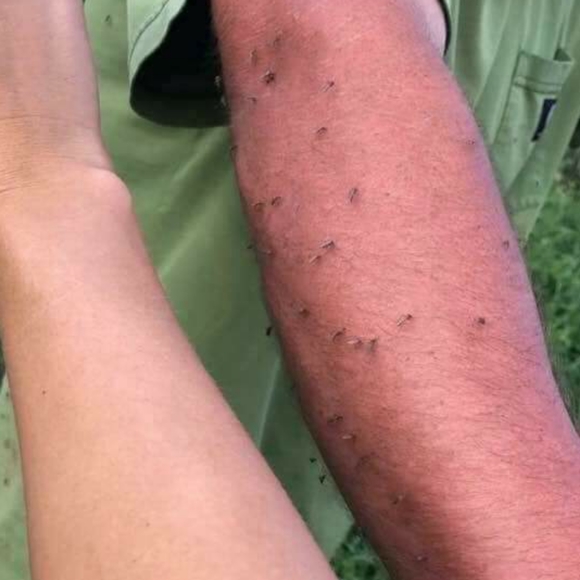 PREORDER ONLY ByeBye Stretch Marks,Mosquitos,Burns - Picture 5 of 16